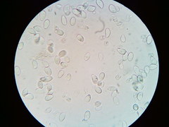 Cylindrobasidium laeve