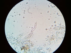 Cylindrobasidium laeve