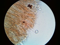 Cylindrobasidium laeve