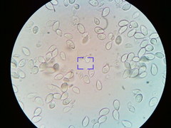 Cylindrobasidium laeve