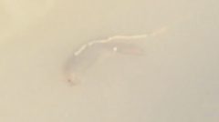 Anostraca