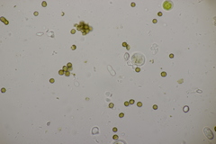 Xanthoriicola physciae