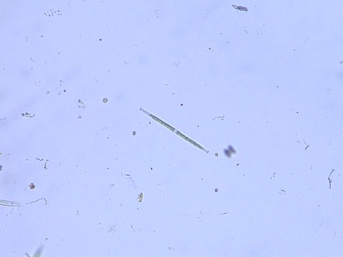 Gonatozygon brebissonii, 2026-01-19