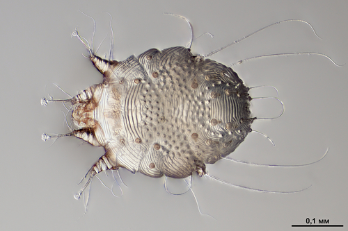 Scabies Mite