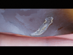 Acotylea