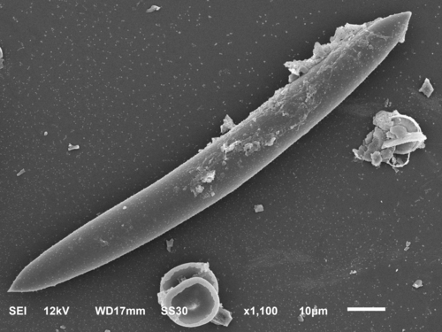Trochospongilla leidii