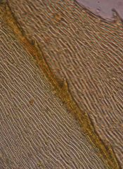 Hypnodendron spininervium