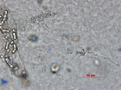 Harposporium