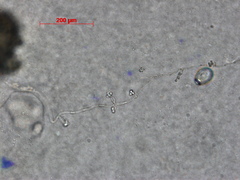 Verticillium