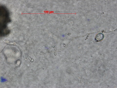 Verticillium