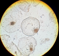 Noctiluca scintillans