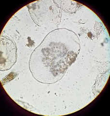 Noctiluca scintillans