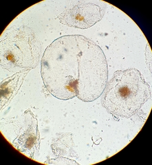 Noctiluca scintillans