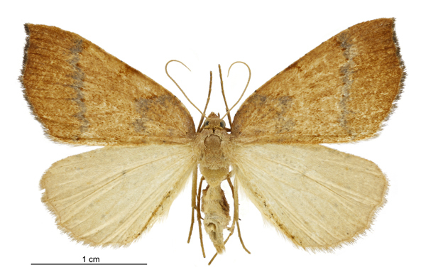 Sestra humeraria