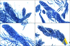 Lathagrium auriforme