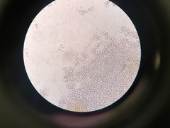 Marchandiomyces corallinus
