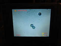 Pseudoplectania vogesiaca