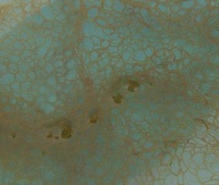 Hydrodictyon reticulatum