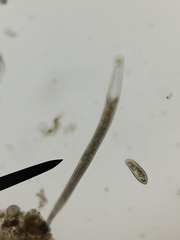 Spirostomum