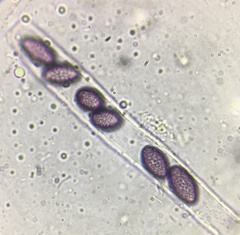 Ascobolus lineolatus