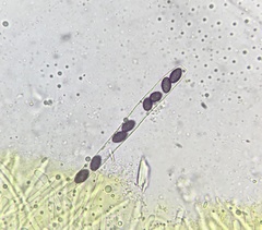 Ascobolus lineolatus