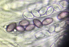 Ascobolus lineolatus