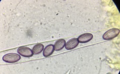Ascobolus crenulatus