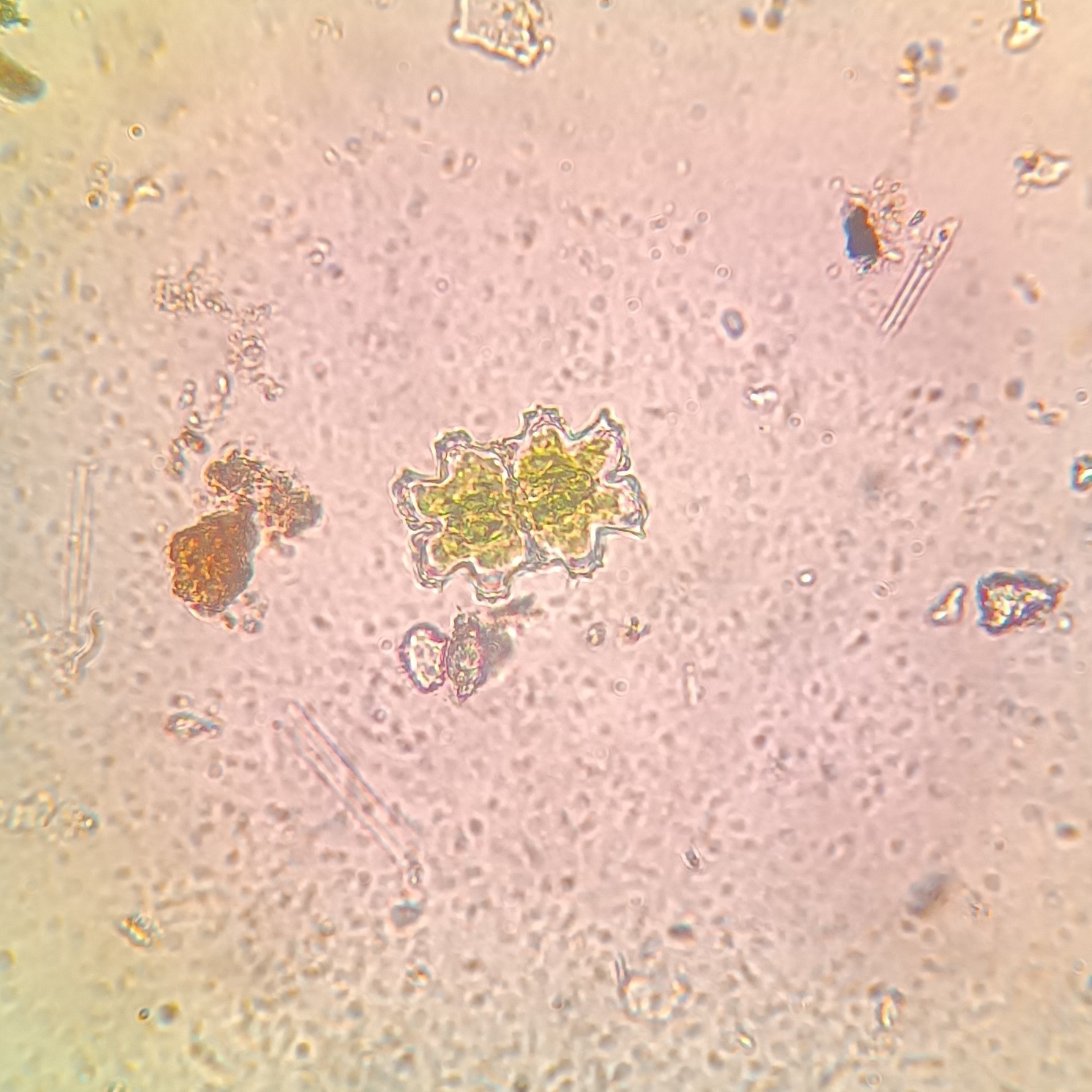 Euastrum abruptum