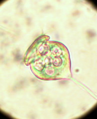 Vorticella