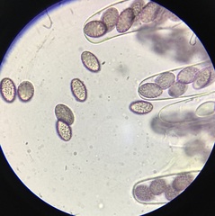 Ascobolus lineolatus