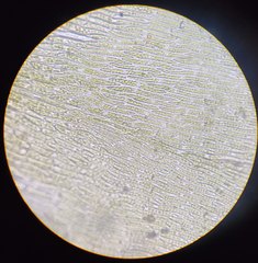 Herzogiella seligeri