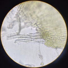 Herzogiella seligeri