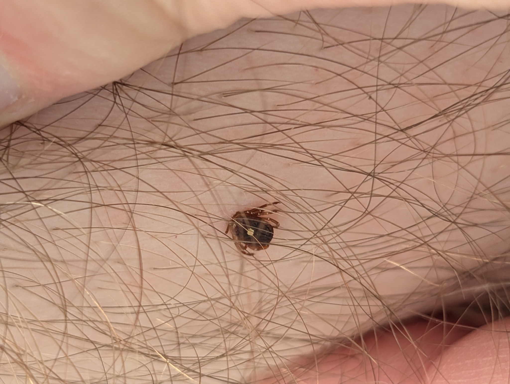 Amblyomma americanum Linnaeus, 1758