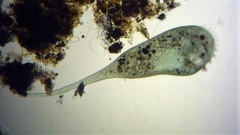 Stentor coeruleus