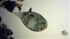Stentor coeruleus