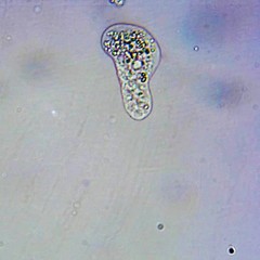 Hartmannellidae