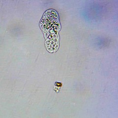 Hartmannellidae