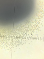 Chaenotheca brunneola