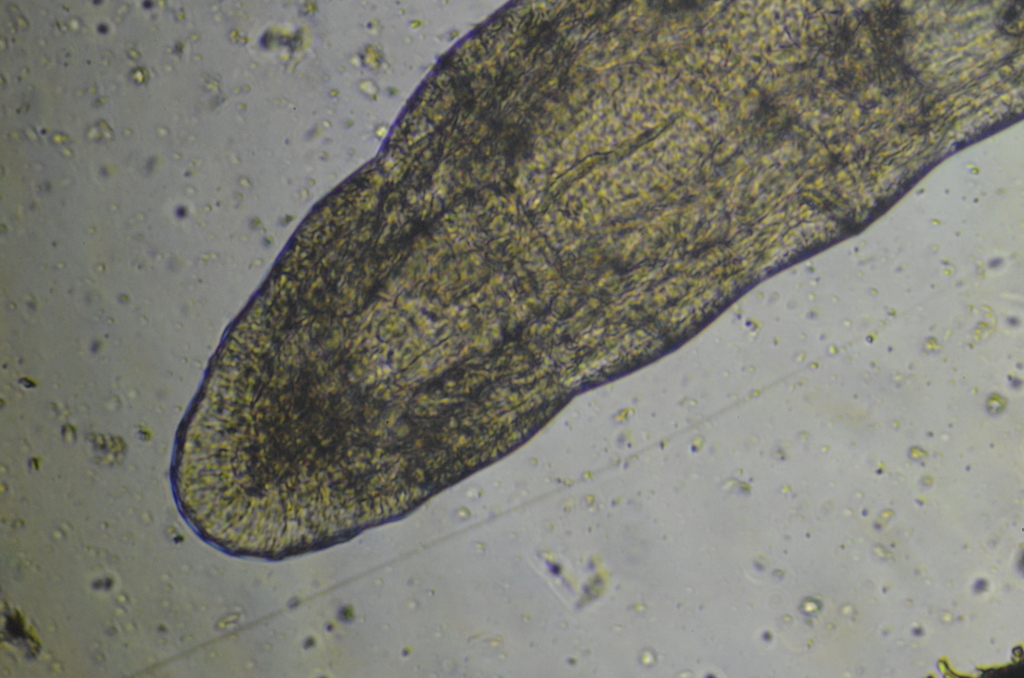 Segmented Worm Microscope Segmented Worms from Weiz, Österreich on March 5, 2026 at 04:27 PM by ...