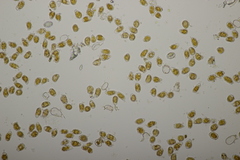 Pucciniastrum epilobii