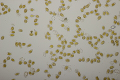 Pucciniastrum epilobii