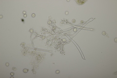 Hyaloperonospora erophilae