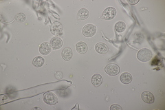 Hyaloperonospora erophilae