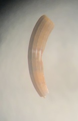 Caecum