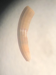 Caecum