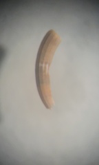 Caecum