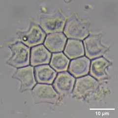 Pseudopediastrum boryanum