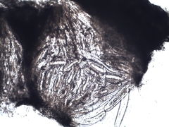 Pertusaria heterochroa