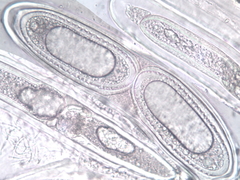 Pertusaria heterochroa