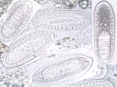 Pertusaria heterochroa